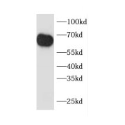 WB analysis of mouse kidney tissue, using CCT8 antibody (1/1500 dilution).