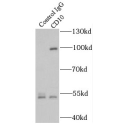 Neprilysin / NEP (MME) Antibody