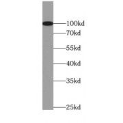 WB analysis of mouse kidney tissue, using MME,CD10 antibody (1/500 dilution).
