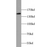 Western blot analysis of Human blood extract, using Integrin Alpha X / CD11C (ITGAX) Antibody (1/500 dilution).