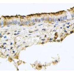 Prominin 1 (PROM1) Antibody