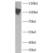 WB analysis of MCF7 cells, using SDC1, CD138 antibody (1/1000 dilution).