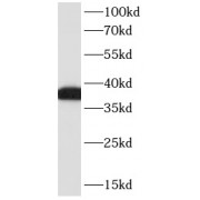 WB analysis of Raji cells, using CD23,FCER2 antibody (1/2000 dilution).