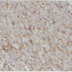 Low Affinity Immunoglobulin Epsilon Fc Receptor / CD23 (FCER2) Antibody