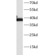 WB analysis of Raji cells, using CD23 antibody (1/2000 dilution).