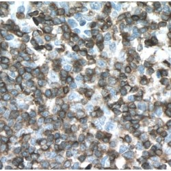 T-Cell Surface Glycoprotein CD3 Epsilon Chain (CD3E) Antibody