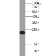 WB analysis of Jurkat cells, using CD3E antibody (1/1000 dilution).