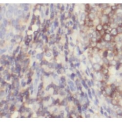 T-Cell Surface Glycoprotein CD3 Epsilon Chain (CD3E) Antibody