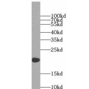 WB analysis of Jurkat cells, using CD3G antibody (1/1000 dilution).