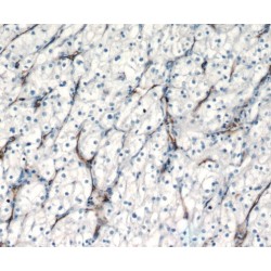 Platelet And Endothelial Cell Adhesion Molecule 1 (PECAM1) Antibody