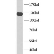 WB analysis of Jurkat cells, using CD31 antibody (1/1000 dilution).