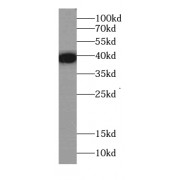 WB analysis of human spleen tissue, using CD336 antibody (1/500 dilution).