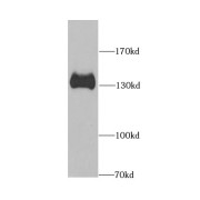 WB analysis of K-562 cells, using SPN antibody (1/1000 dilution).