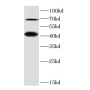 WB analysis of Raji cells, using CD84 antibody (1/3000 dilution).