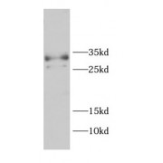 WB analysis of U-937 cells, using CD99 antibody (1/1000 dilution).