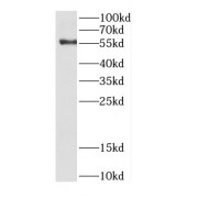 WB analysis of SMMC-7721 cells, using CDC14B antibody (1/300 dilution).