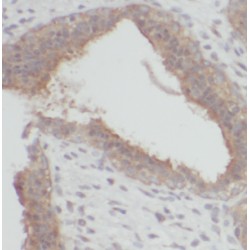 Cell Division Cycle 25A (CDC25A) Antibody