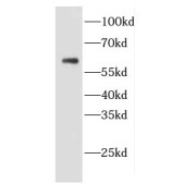 WB analysis of HepG2 cells, using CDC25A antibody (1/1500 dilution).