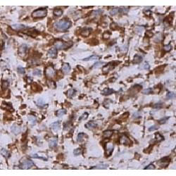 Cell Division Cycle 25B (CDC25B) Antibody