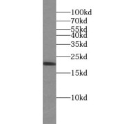 WB analysis of mouse brain tissue, using CDC42 antibody (1/1000 dilution).