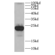 WB analysis of K-562 cells, using CDC42EP2 antibody (1/200 dilution).