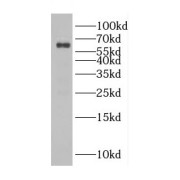 WB analysis of K-562 cells, using CDC45L antibody (1/500 dilution).