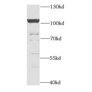 WB analysis of MCF7 cells, using CDC5L antibody (1/1000 dilution).