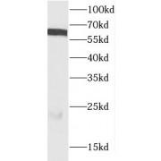 WB analysis of HeLa cells, using CDC6 antibody (1/400 dilution).