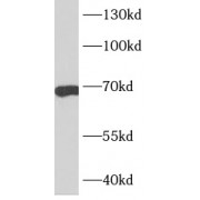 WB analysis of HeLa cells, using CDC6 antibody (1/1000 dilution).