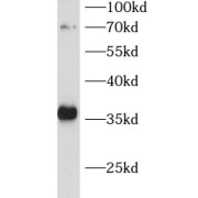 WB analysis of A549 cells, using CDCA5 antibody (1/500 dilution).