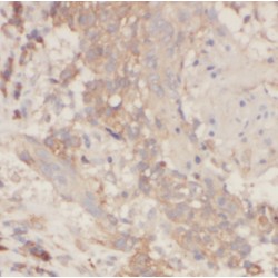 Borealin (CDCA8) Antibody