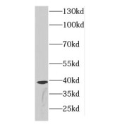 WB analysis of mouse kidney tissue, using CDCA8 antibody (1/300 dilution).