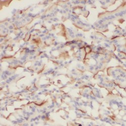 Cadherin 17 (CDH17) Antibody