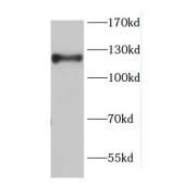 WB analysis of mouse small intestine tissue, using CDH17 antibody (1/2000 dilution).