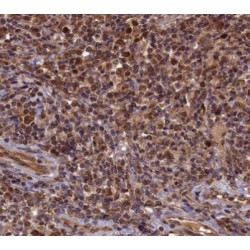 Cyclin-Dependent Kinase 1 (CDK1) Antibody