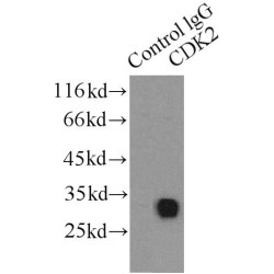 Cyclin Dependent Kinase 2 (CDK2) Antibody