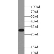 WB analysis of HeLa cells, using CDK2 antibody (1/500 dilution).