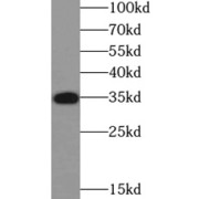 WB analysis of K-562 cells, using CDK2 antibody (1/1000 dilution).