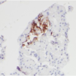 CDK5 Regulatory Subunit Associated Protein 1 (CDK5RAP1) Antibody