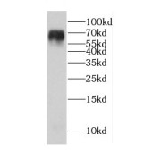 WB analysis of human heart tissue, using CDK5RAP1 antibody (1/2000 dilution).