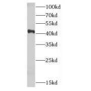 WB analysis of A431 cells, using CDK9 antibody (1/1000 dilution).