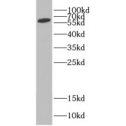 WB analysis of HeLa cells, using CDKN2AIP antibody (1/1000 dilution).