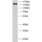 WB analysis of SH-SY5Y cells, using CDON antibody (1/1000 dilution).