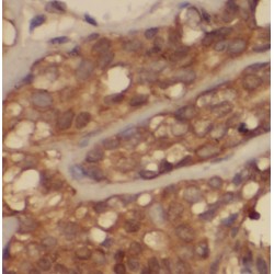 Cerebellar Degeneration Related Protein 2 (CDR2) Antibody
