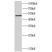 WB analysis of Y79 cells, using CDS2 antibody (1/500 dilution).