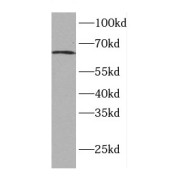 WB analysis of Jurkat cells, using CDT1 antibody (1/500 dilution).