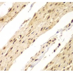 Caudal Type Homeobox 1 (CDX1) Antibody