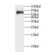 WB analysis of PC-3 cells, using CDYL antibody (1/3000 dilution).