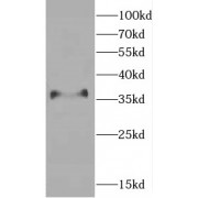 WB analysis of RAW 264.7 cells, using CEBPB antibody (1/300 dilution).
