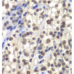 Centromere Protein C (CENPC) Antibody